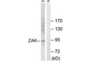 Western blot analysis of extracts from Jurkat cells, using ZAK (Ab-165) Antibody. (ZAK antibody  (AA 131-180))