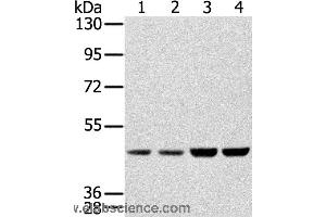 Western blot analysis of Hela, Raji, 231 and K562 cell, using SSB Polyclonal Antibody at dilution of 1:400 (SSB antibody)