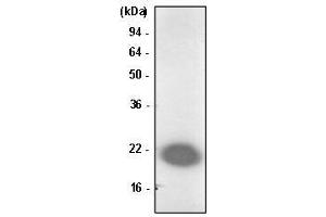 Jurkat cell lysate was resolved by SDS-PAGE, transferred to PVDF membrane and probed with anti-human Park7/DJ-1 antibody (1:1000). (PARK7/DJ1 antibody  (AA 1-189))