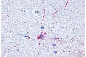 Anti-GRM8 / MGLUR8 antibody  ABIN1048946 IHC staining of human brain, neurons and glia. (GRM8 antibody  (C-Term))