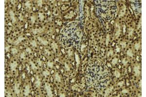 Immunohistochemistry (IHC) image for anti-Phosphatidylinositol-4-Phosphate 3-Kinase, Catalytic Subunit Type 2 beta (PIK3C2B) (Internal Region) antibody (ABIN6259486)