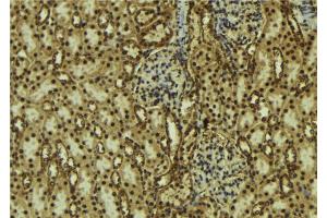 ABIN6273754 at 1/100 staining Mouse kidney tissue by IHC-P. (PIK3C2B antibody  (Internal Region))