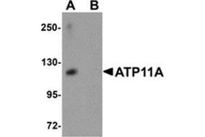 Western blot analysis of ATP11A in K562 cell tissue lysate with ATP11A antibody at 1 μg/ml in (A) the absence and (B) the presence of blocking peptide.