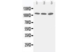 Anti-Zonula occludens protein 3 antibody, Western blotting Lane 1: PANC Cell Lysate Lane 2: A549 Cell Lysate Lane 3: HELA Cell Lysate (TJP3 antibody  (C-Term))