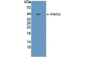 Detection of Recombinant GHR, Human using Polyclonal Antibody to Growth Hormone Receptor (GHR) (Growth Hormone Receptor antibody  (AA 315-574))