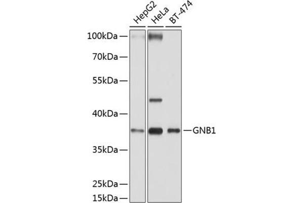 GNB1 antibody  (AA 1-340)