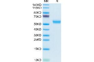 Cynomolgus BAFF Trimer on Tris-Bis PAGE under reduced condition. (BAFF Protein (AA 141-285, Trimer) (His-Avi Tag))