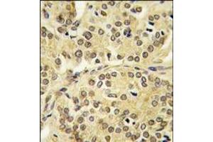 Image no. 1 for anti-Kruppel-Like Factor 10 (KLF10) (AA 19-49), (N-Term) antibody (ABIN360044) (KLF10/TIEG1 antibody  (N-Term))