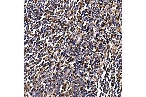 Immunohistochemistry of paraffin-embedded human tonsil using C Rabbit pAb (ABIN6130035, ABIN6137891, ABIN6137892 and ABIN6220925) at dilution of 1:100 (40x lens). (CAMK4 antibody  (AA 304-473))