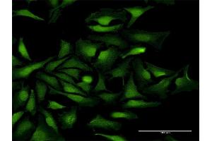 Immunofluorescence of purified MaxPab antibody to KIAA0101 on HeLa cell. (KIAA0101 antibody  (AA 1-111))