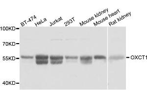 Western blot analysis of extracts of various cell lines, using OXCT1 antibody. (OXCT1 antibody)
