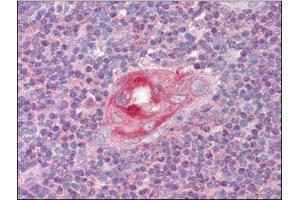 Human Thymus (formalin-fixed, paraffin-embedded) stained with RGS1followed by biotinylated anti-goat IgG secondary antibody, alkaline phosphatase-streptavidin and chromogen. (RGS1 antibody  (C-Term))