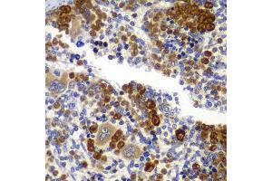 Immunohistochemistry of paraffin-embedded rat spleen using PRKAB1 antibody (ABIN5995401) at dilution of 1/100 (40x lens). (PRKAB1 antibody)