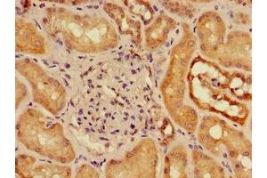 Immunohistochemistry of paraffin-embedded human kidney tissue using ABIN7160177 at dilution of 1:100 (SLC16A9 antibody  (AA 185-304))