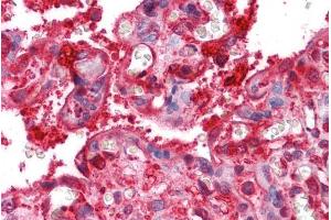ABIN185665 (2. (Radixin antibody  (Internal Region))