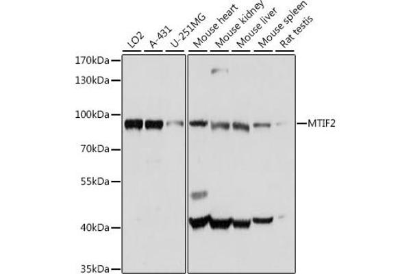 MTIF2 抗体  (AA 428-727)