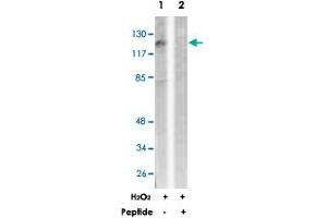 Western blot analysis of extracts from LoVo cells, treated with H 2 O 2  (100 uM, 30 mins), using PDGFRB polyclonal antibody . (PDGFRB antibody)