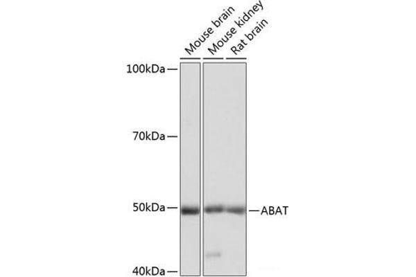 ABAT antibody