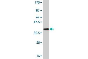 Western Blot detection against Immunogen (33. (COL23A1 antibody  (AA 338-410))