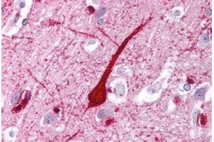 Human Brain, Cortex (formalin-fixed, paraffin-embedded) stained with E2F4 antibody ABIN214109 at 5 ug/ml followed by biotinylated goat anti-rabbit IgG secondary antibody ABIN481713, alkaline phosphatase-streptavidin and chromogen. (E2F4 antibody  (C-Term))