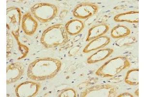 Immunohistochemistry of paraffin-embedded human kidney tissue using ABIN7171975 at dilution of 1:100 (TPK1 antibody  (AA 1-243))