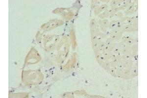 Immunohistochemistry of paraffin-embedded human heart tissue using ABIN7145177 at dilution of 1:100