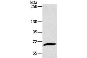 Western Blot analysis of Mouse liver tissue using CD42b Polyclonal Antibody at dilution of 1:800 (CD42b antibody)