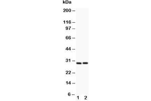 Western blot testing of Bcl2A1 antibody and (1) HeLa, (2) Jurkat lysate (BCL2A1 antibody  (N-Term))