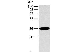 Western Blot analysis of Human fetal intestine tissue using ITLN1 Polyclonal Antibody at dilution of 1:400 (ITLN1/Omentin antibody)