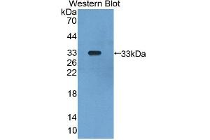 Western blot analysis of the recombinant protein. (GLMN antibody  (AA 294-549))