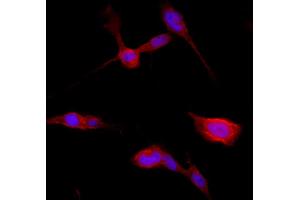 Confocal immunofluorescence - anti-Catenin beta1 Ab in BEAS-2B cells at 1/250 dilution, cells were fixed with 4% of PFA, (beta Catenin antibody  (C-Term))