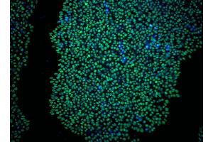 Immunoflourescent staining of Sox2 in human embryonic stem (ES) cells. (SOX2 antibody)