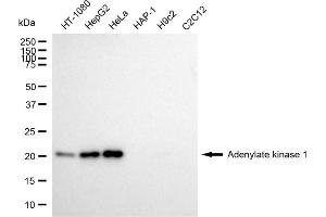 Western blotting analysis using Adenylate kinase 1 antibody (ABIN7797519). (Adenylate Kinase 1 antibody)