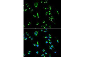 Immunofluorescence analysis of MCF-7 cells using APOBEC3G antibody. (APOBEC3G antibody)