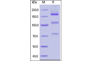 Rabbit Complement C5, His Tag on  under reducing (R) condition. (C5 Protein (AA 19-1678) (His tag))
