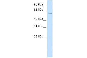 WB Suggested Anti-HOXD3 Antibody Titration:  0. (HOXD3 antibody  (C-Term))