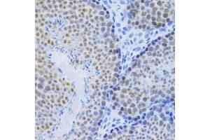 Immunohistochemistry of paraffin-embedded mouse testis using MCM4 Antibody (ABIN5971548) at dilution of 1/100 (40x lens). (MCM4 antibody)