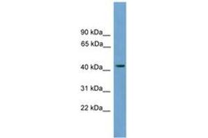 Image no. 1 for anti-Major Facilitator Superfamily Domain Containing 3 (MFSD3) (AA 179-228) antibody (ABIN6744914) (MFSD3 antibody  (AA 179-228))