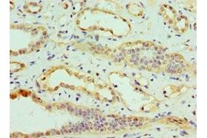 Immunohistochemistry of paraffin-embedded human kidney tissue using ABIN7147891 at dilution of 1:100 (CLDN14 antibody  (AA 140-239))