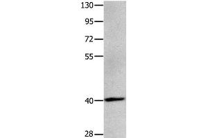 Western Blot analysis of Human brain glioma tissue using MAGEB4 Polyclonal Antibody at dilution of 1:550 (MAGEB4 antibody)