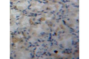 Used in DAB staining on fromalin fixed paraffin-embedded stomach tissue (FABP5 antibody  (AA 2-135))