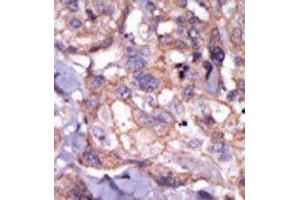 Image no. 1 for anti-TXK tyrosine Kinase (TXK) (N-Term) antibody (ABIN359999) (TXK antibody  (N-Term))