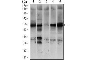 Western blot analysis using NR6A1 mouse mAb against K562 (1), NTERA-2 (2), HEK293 (3), HUVE-12 (4), and HeLa (5) cell lysate. (NR6A1 antibody  (AA 65-118))