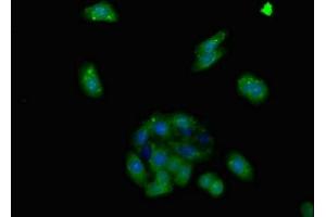 Immunofluorescent analysis of HepG2 cells using ABIN7143372 at dilution of 1:100 and Alexa Fluor 488-congugated AffiniPure Goat Anti-Rabbit IgG(H+L) (GPR124 antibody  (AA 1069-1338))