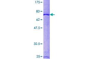 RCC1 Protein (AA 1-421) (GST tag)