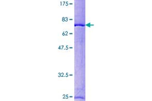 RCC1 Protein (AA 1-421) (GST tag)