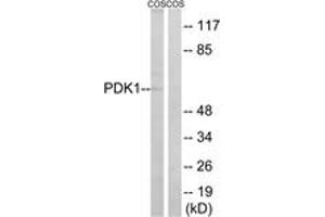 Western blot analysis of extracts from COS cells, using PDK1 (Ab-9) Antibody.