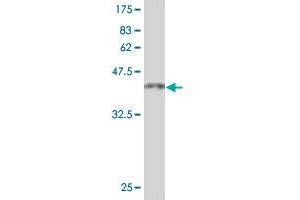 Western Blotting (WB) image for anti-Topoisomerase I Binding, arginine/serine-Rich, E3 Ubiquitin Protein Ligase (TOPORS) (AA 98-205) antibody (ABIN564417)