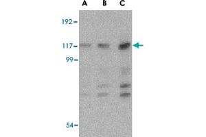 Western blot analysis of IFIH1 in Daudi cell lysate with IFIH1 polyclonal antibody  at (A) 1, (B) 2 and (C) 4 ug/mL . (IFIH1 antibody  (Internal Region))
