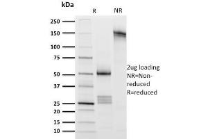 SDS-PAGE Analysis Purified CD8 Mouse Monoclonal Antibody (UCHT4). (CD8 alpha antibody)